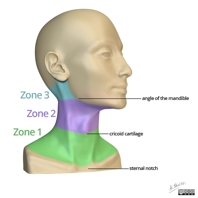 enetrating Neck Injuries - REBEL EM - Emergency Medicine Blog